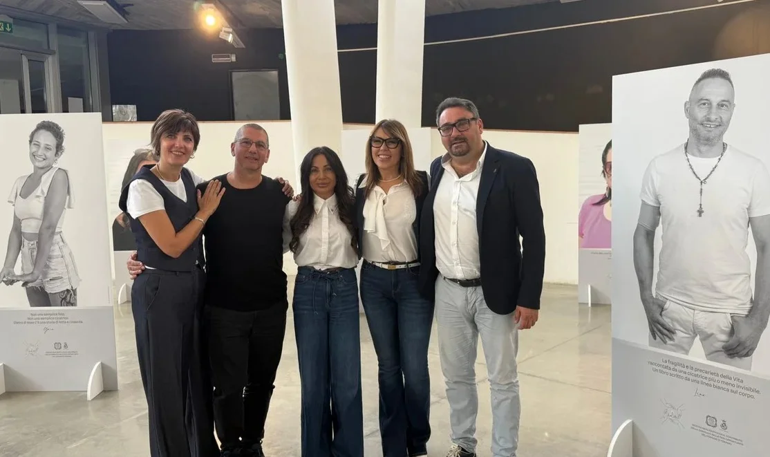 FOTO e VIDEO | “Oltre le cicatrici", una mostra che dà forza a ciò che resta invisibile