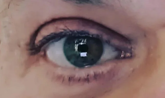 Glaucoma, a Castelnuovo Vomano una giornata di screening per la prevenzione