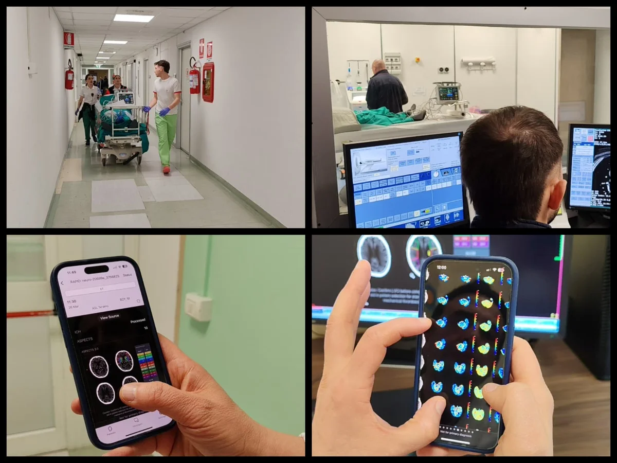 VIDEO | Ictus e intelligenza artificiale, sistema innovativo al "Mazzini" di Teramo